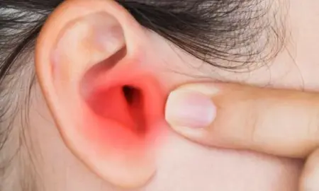 طرق طبيعية لعلاج التهاب الأذن الوسطى 2