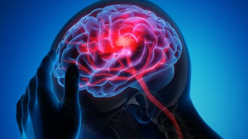 سرطان الدماغ