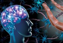 «التصلب المتعدد»