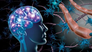 «التصلب المتعدد»