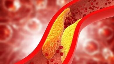 الكوليسترول