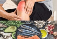 التهاب المفاصل