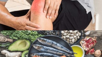 التهاب المفاصل