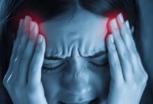 الصداع النصفي