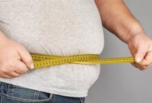 علاج السمنة