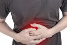 التهاب المعدة
