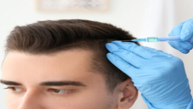 زراعة الشعر