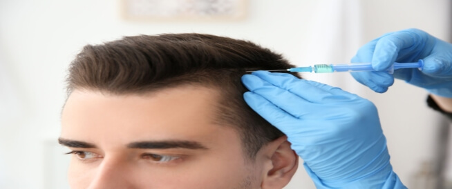 زراعة الشعر