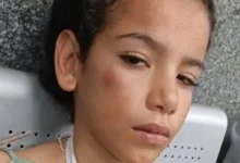 سقوط طفلة