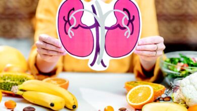 كليتيك