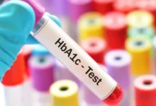 تحليل HbA1c