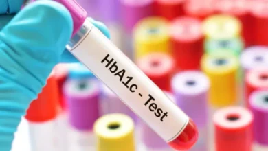 تحليل HbA1c