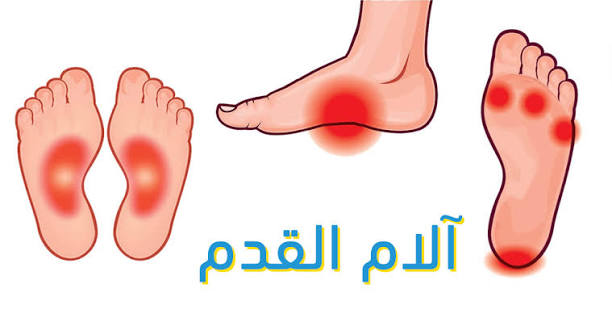 لآلام القدم
