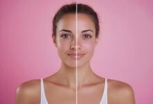 Skin Booster